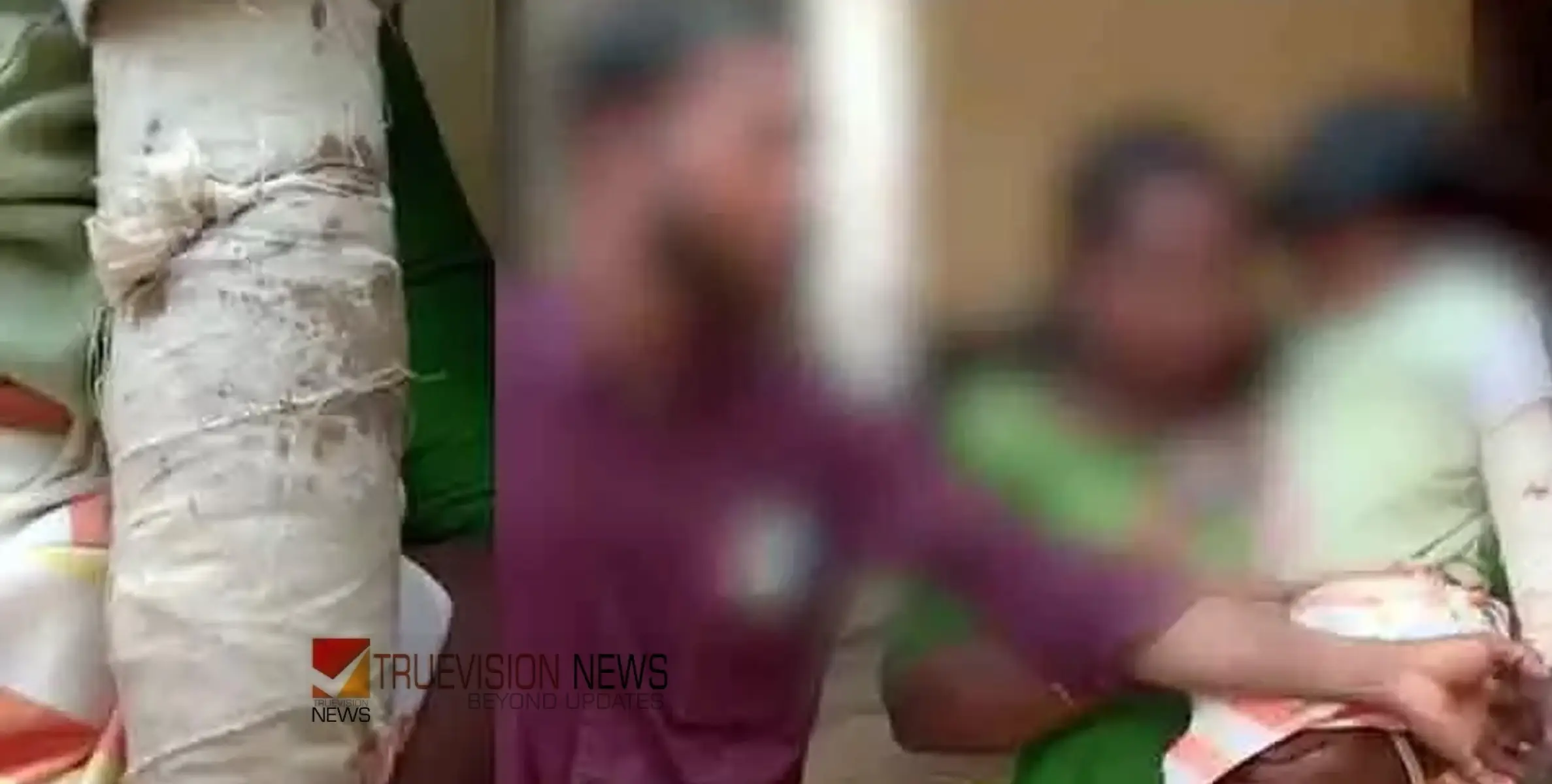 കോഴിക്കോട് താമരശ്ശേരിയിൽ മൂന്ന് വയസുകാരിയുടെ കൈ പിടിച്ച് തിരിച്ചു; അംഗനവാടി അധ്യാപികയ്ക്കെതിരെ പരാതിയുമായി കുടുംബം