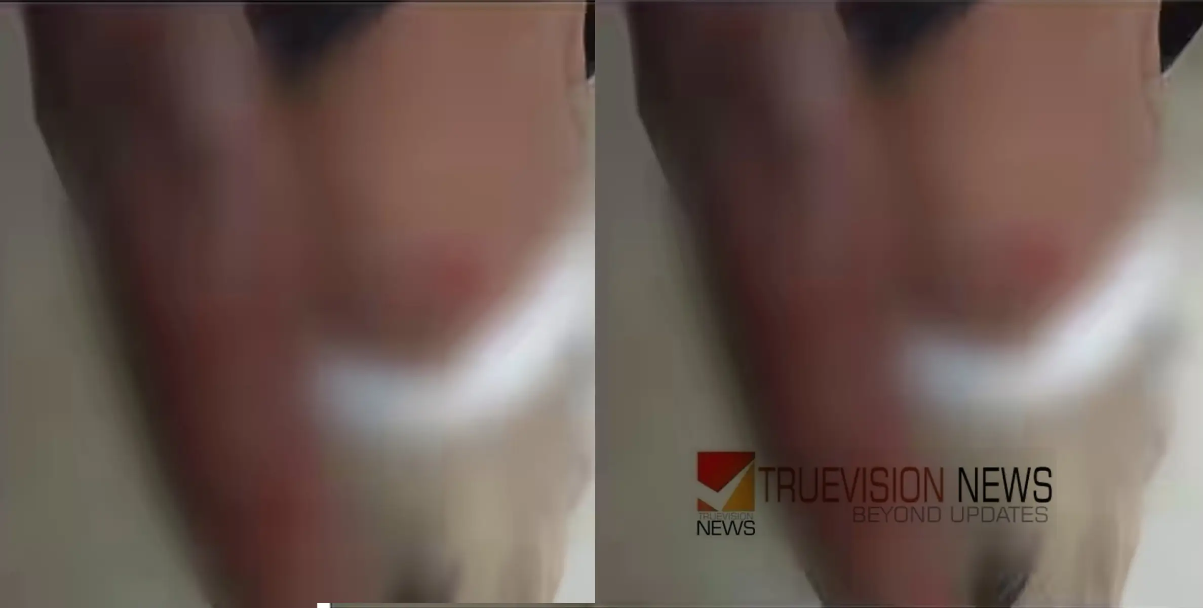 പാലക്കാട് കാട്ടുപന്നി കുറുകെചാടി ബൈക്ക് നിയന്ത്രണം വിട്ട് മറിഞ്ഞ് അപകടം; രണ്ട് പേർക്ക് പരിക്ക്