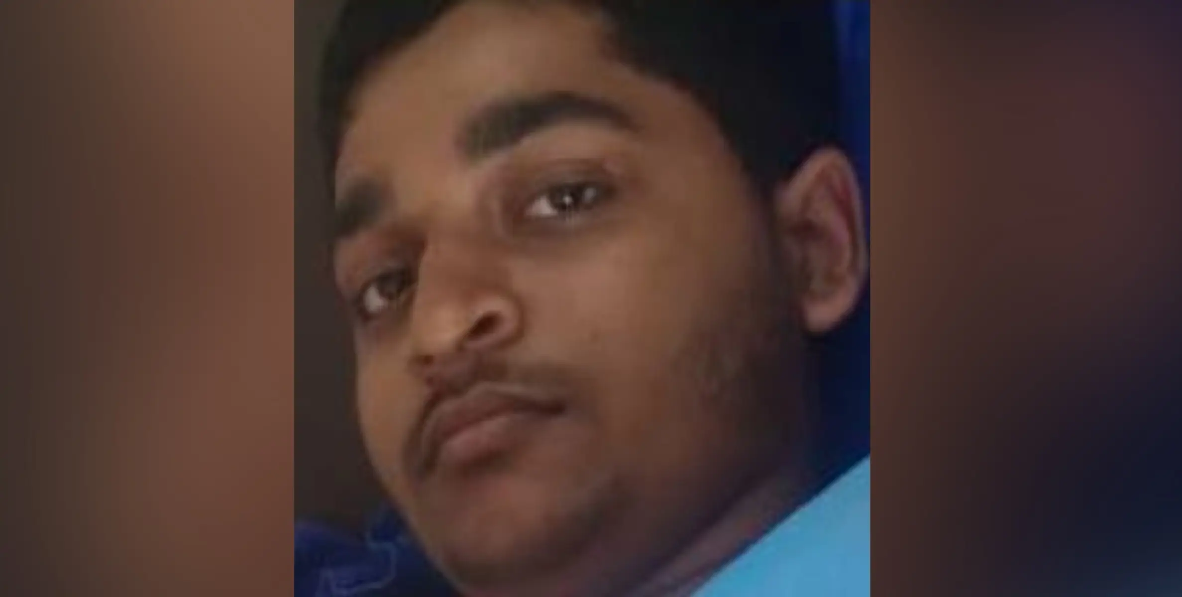 മുള്ളൻ പന്നിയുടെ ആക്രമണത്തിൽ പ്ലസ് വൺ വിദ്യാർത്ഥിക്ക് പരിക്ക്.