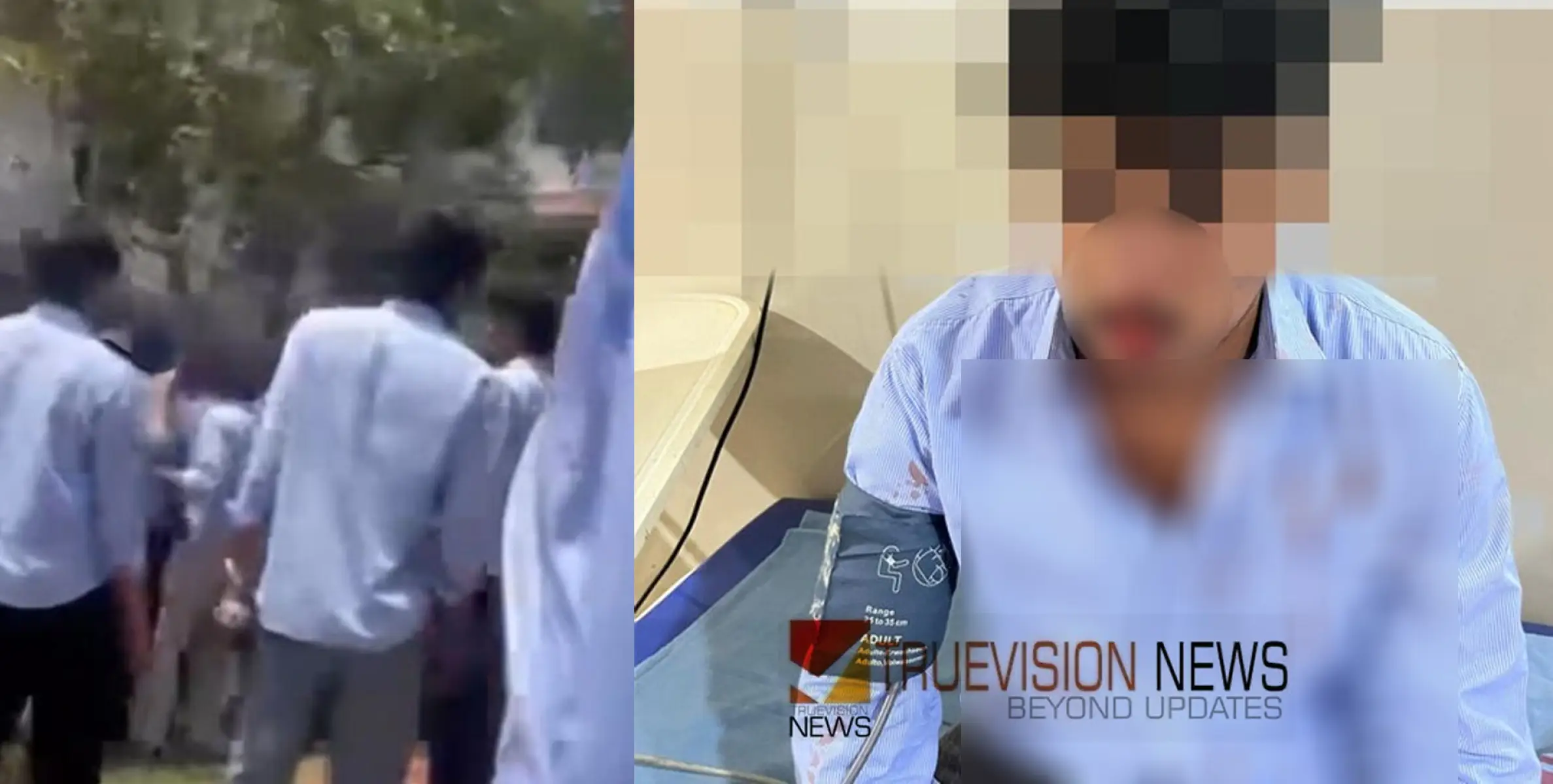 വയനാട് എൻജിനീയറിങ് കോളജിൽ സംഘർഷം, എസ്എഫ്ഐ–യുഡിഎസ്എഫ് ഏറ്റുമുട്ടൽ; അഞ്ച് വിദ്യാർഥികൾക്ക് പരിക്ക്