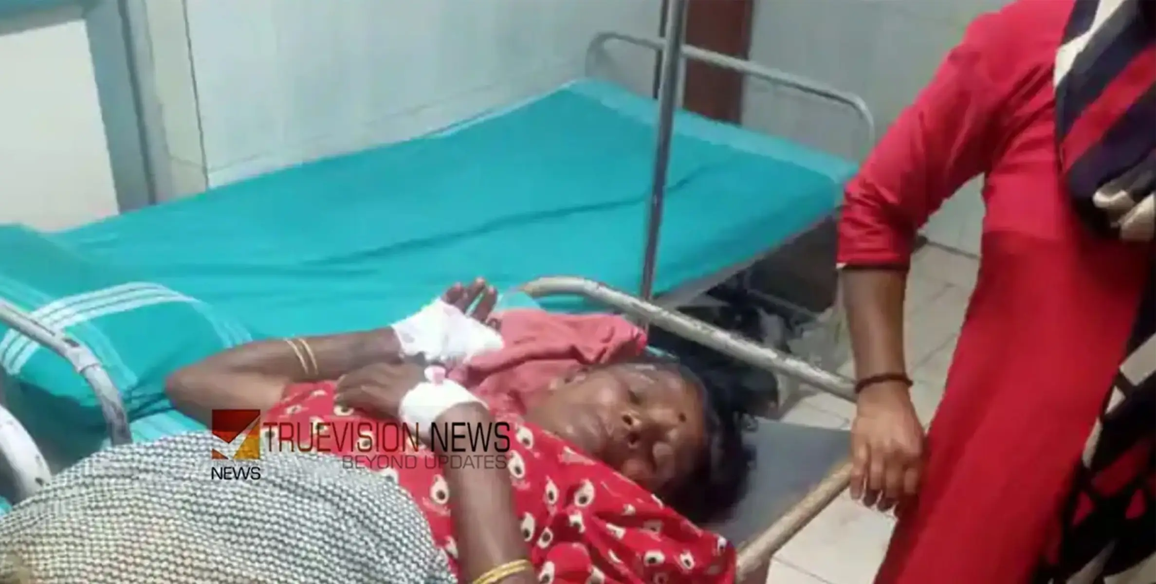 കാട്ടുപന്നി ആക്രമണത്തിൽ സ്ത്രീക്ക് ഗുരുതര പരിക്ക്