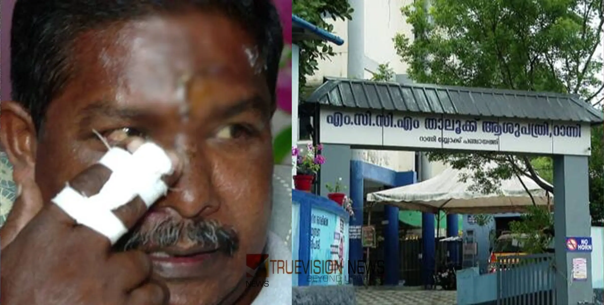 അസഹനീയമായ വേദന; താലൂക്ക് ആശുപത്രിയിൽ നിന്ന് തുന്നിക്കെട്ടിയ മുറിവിനുള്ളിൽ നിന്ന് നീക്കിയത് ഉറുമ്പുകളെ, പരാതി