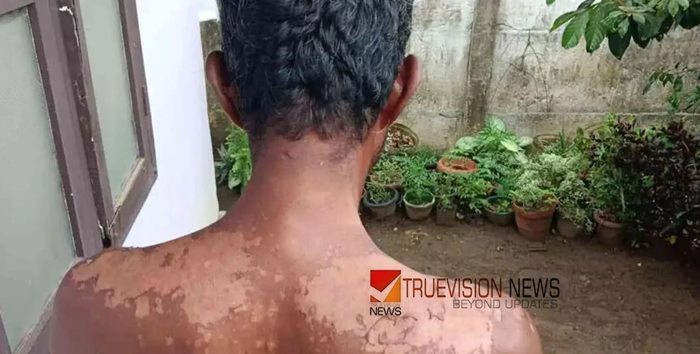 കടുങ്ങല്ലൂരിൽ മത്സ്യ വിൽപനക്കാരന് സൂര്യാതപമേറ്റു