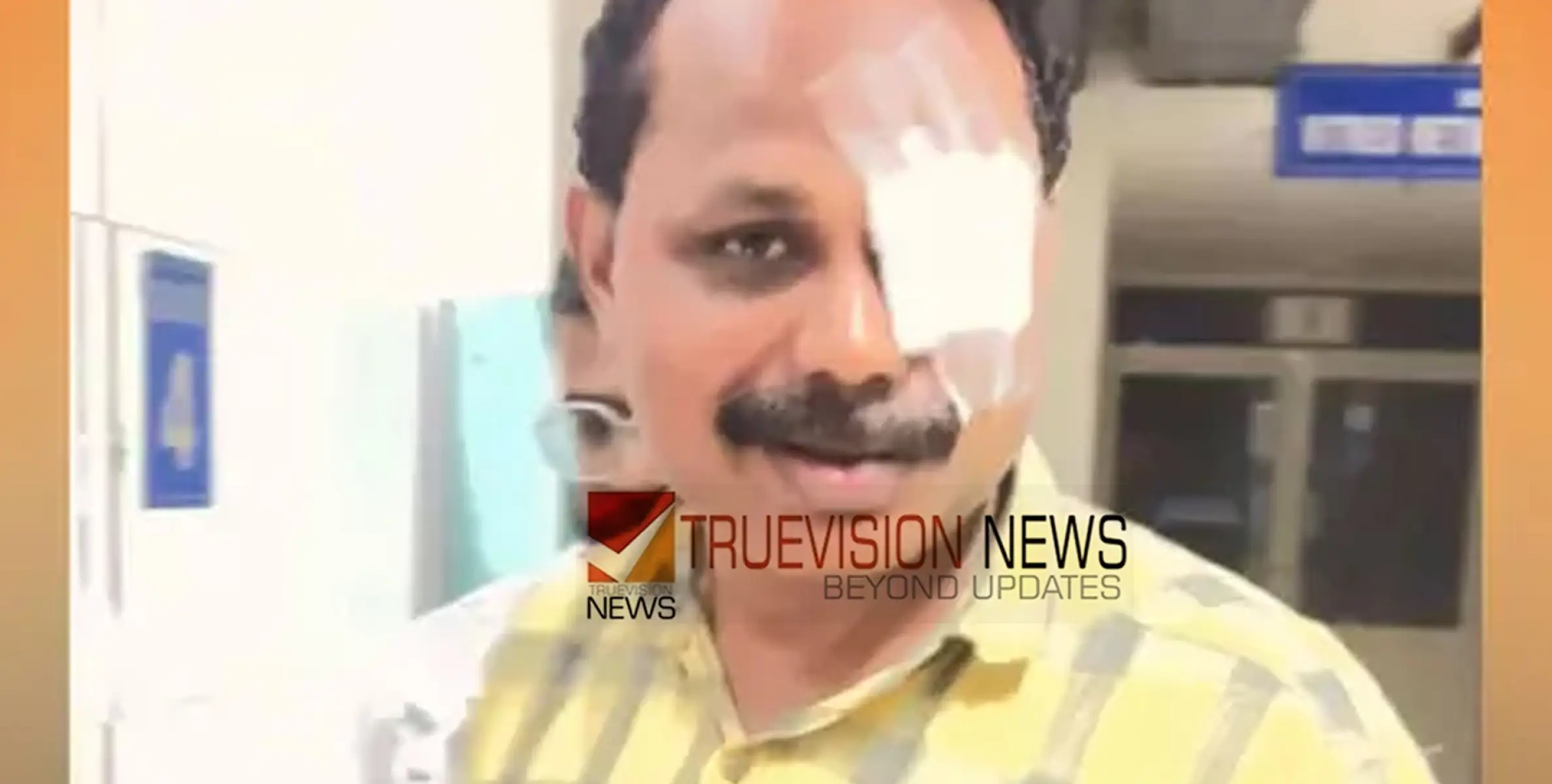 കോഴിക്കോട്  ദ​മ്പ​തി​ക​ളെ ആ​ക്ര​മി​ക്കാ​ൻ ശ്ര​മി​ച്ച യു​വാ​വി​നെ ചോ​ദ്യം ചെ​യ്ത കൗ​ൺ​സി​ല​ർ​ക്ക് ക്രൂ​ര​മ​ർദ്ദ​നം