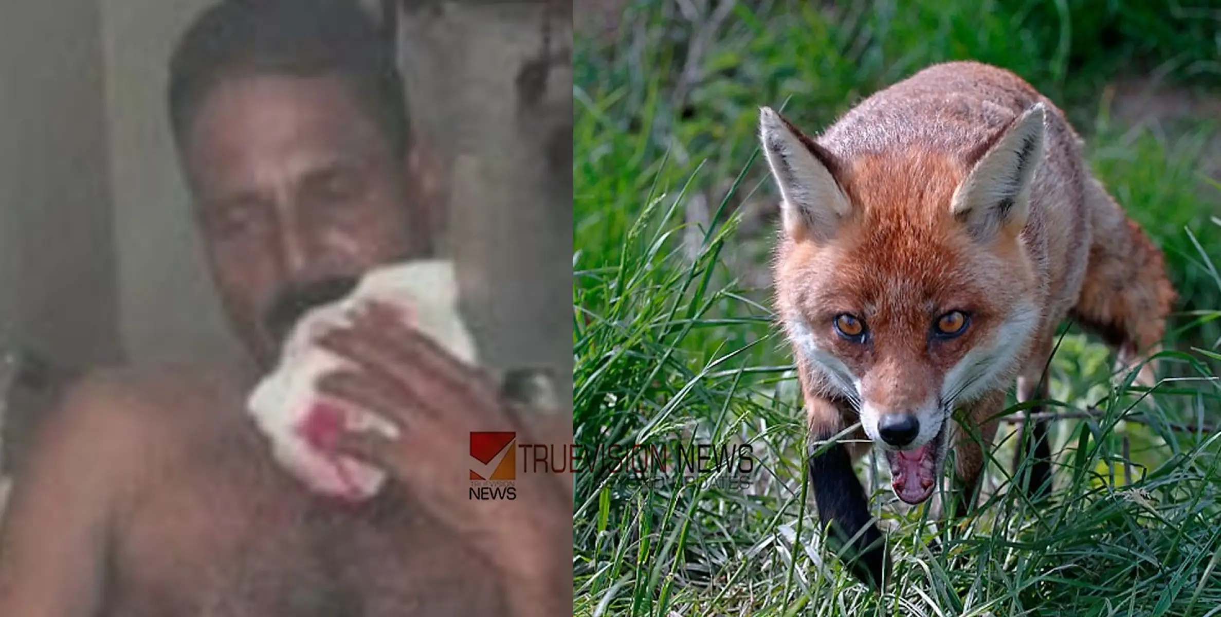 കോഴിക്കോട് വടകരയിൽ കുറുക്കന്റെ ആക്രമണം; യുവാവിന് ഗുരുതര പരിക്ക്