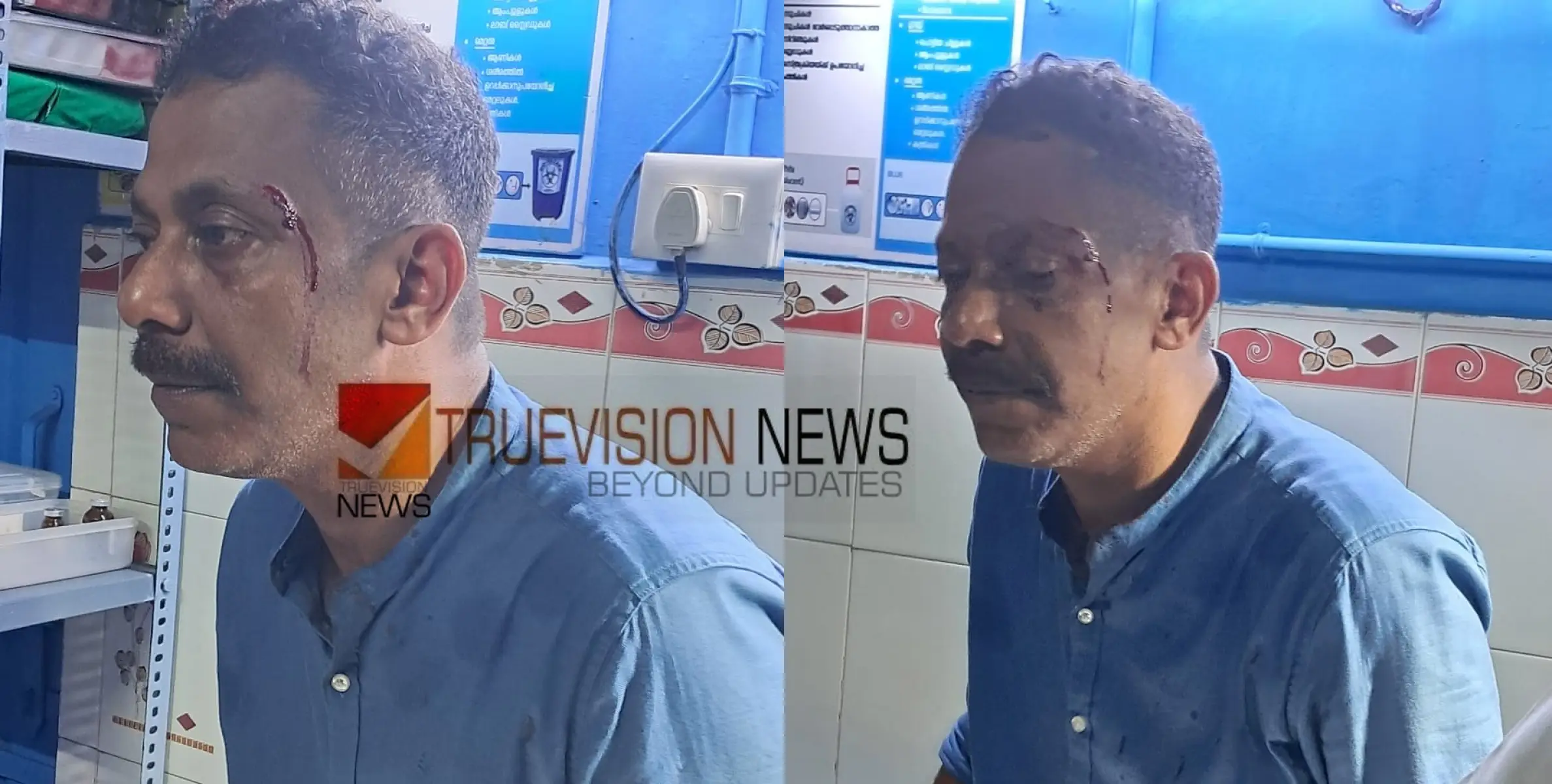 സ്വത്ത് തട്ടാൻ വധശ്രമമെന്ന് പരാതി; നാദാപുരം വളയത്ത് പ്രവാസി ബിസിനസ്കാരനെ വീട്ടിൽ കയറി ക്രൂരമായി അക്രമിച്ചു