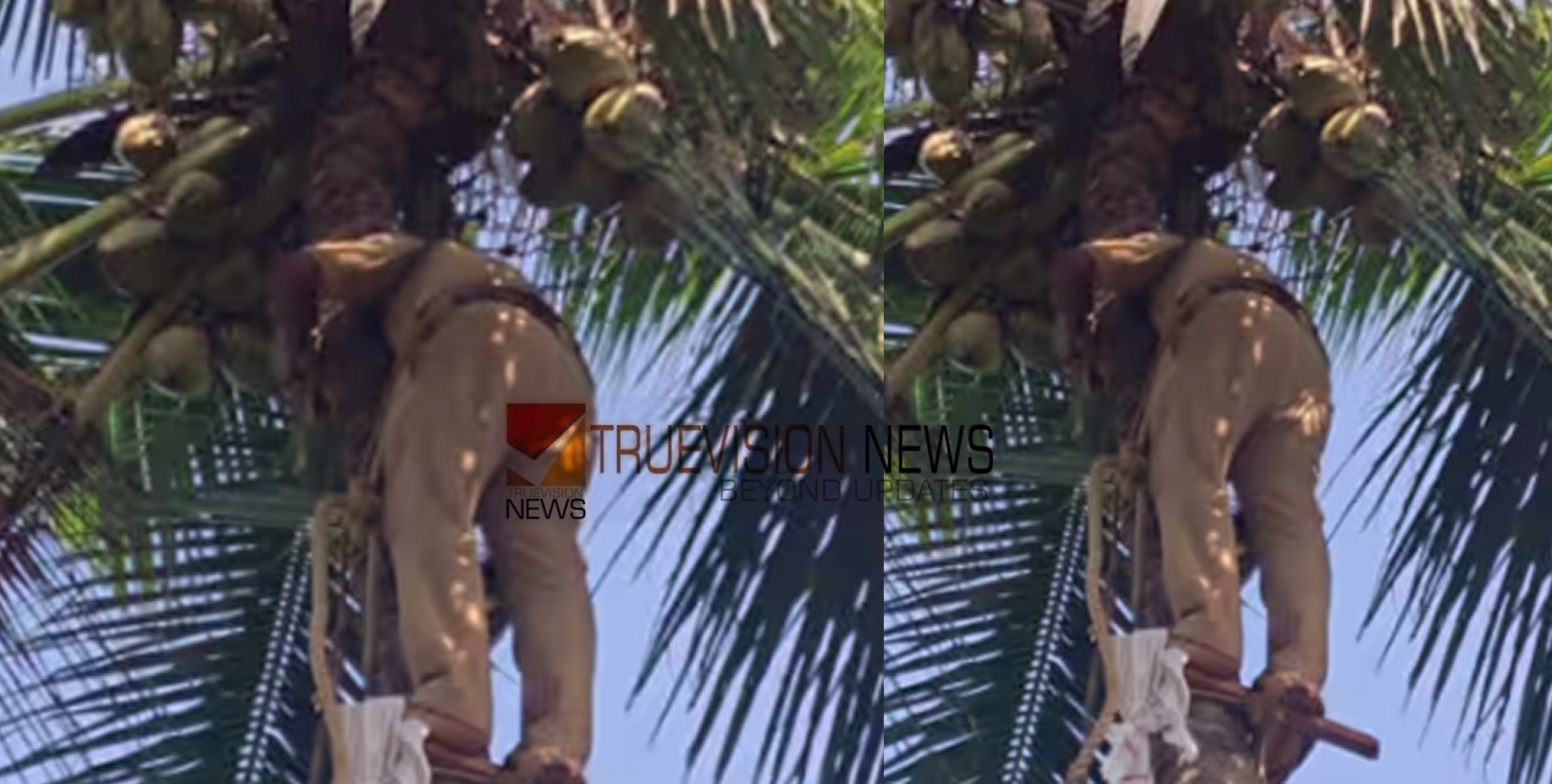 കോഴിക്കോട് തെങ്ങിൽ കയറി ഓല വെട്ടുന്നതിനിടയില്‍ കൈ മുറിഞ്ഞു; വയോധികന് രക്ഷകനായി അഗ്നിരക്ഷാസേന