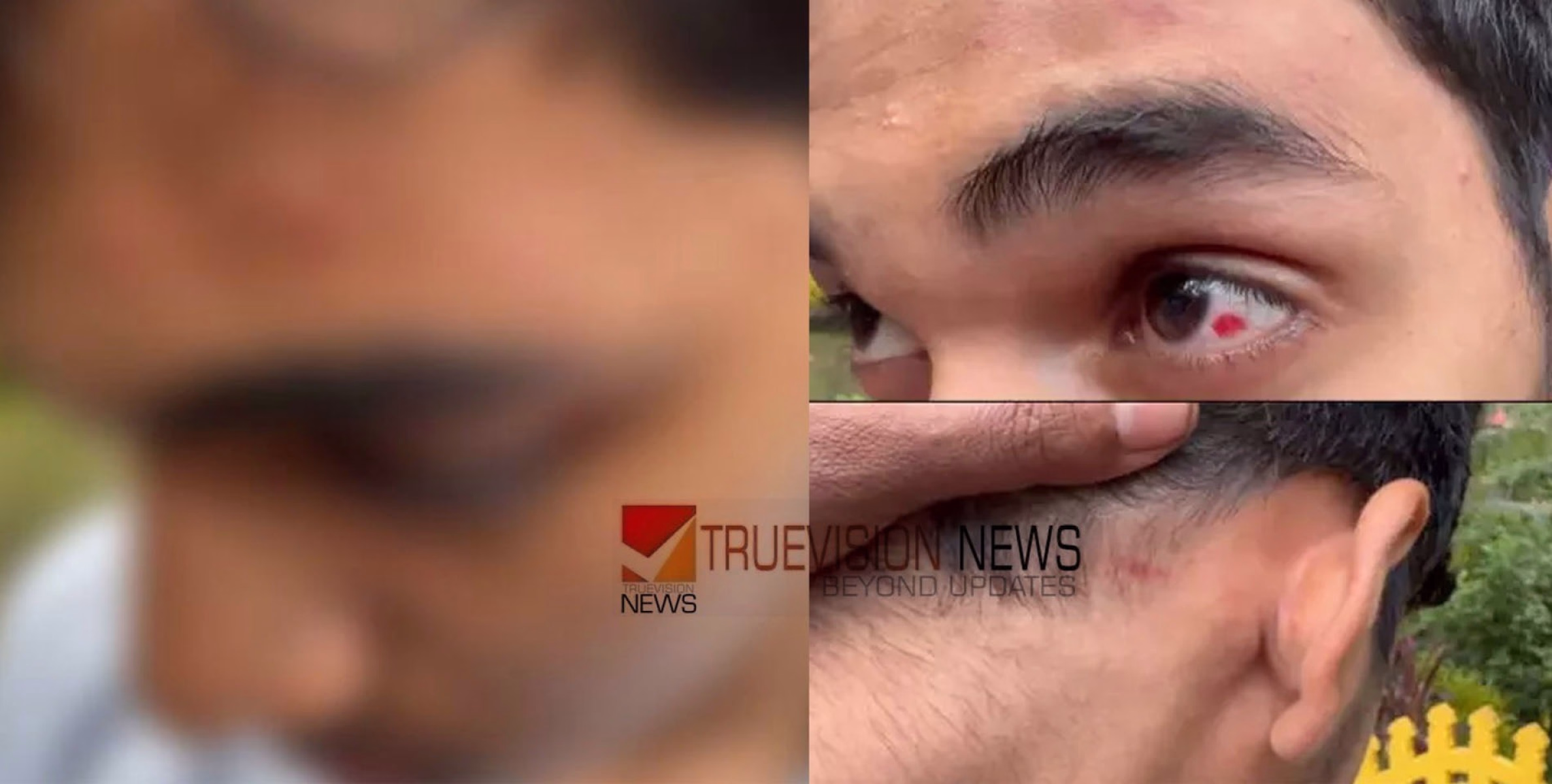യൂണിഫോമിൽ കുത്തിവരച്ചത് ചോദ്യംചെയ്ത പ്ലസ് ടു വിദ്യാർഥിക്ക് സഹപാഠികളുടെ മർദ്ദനം