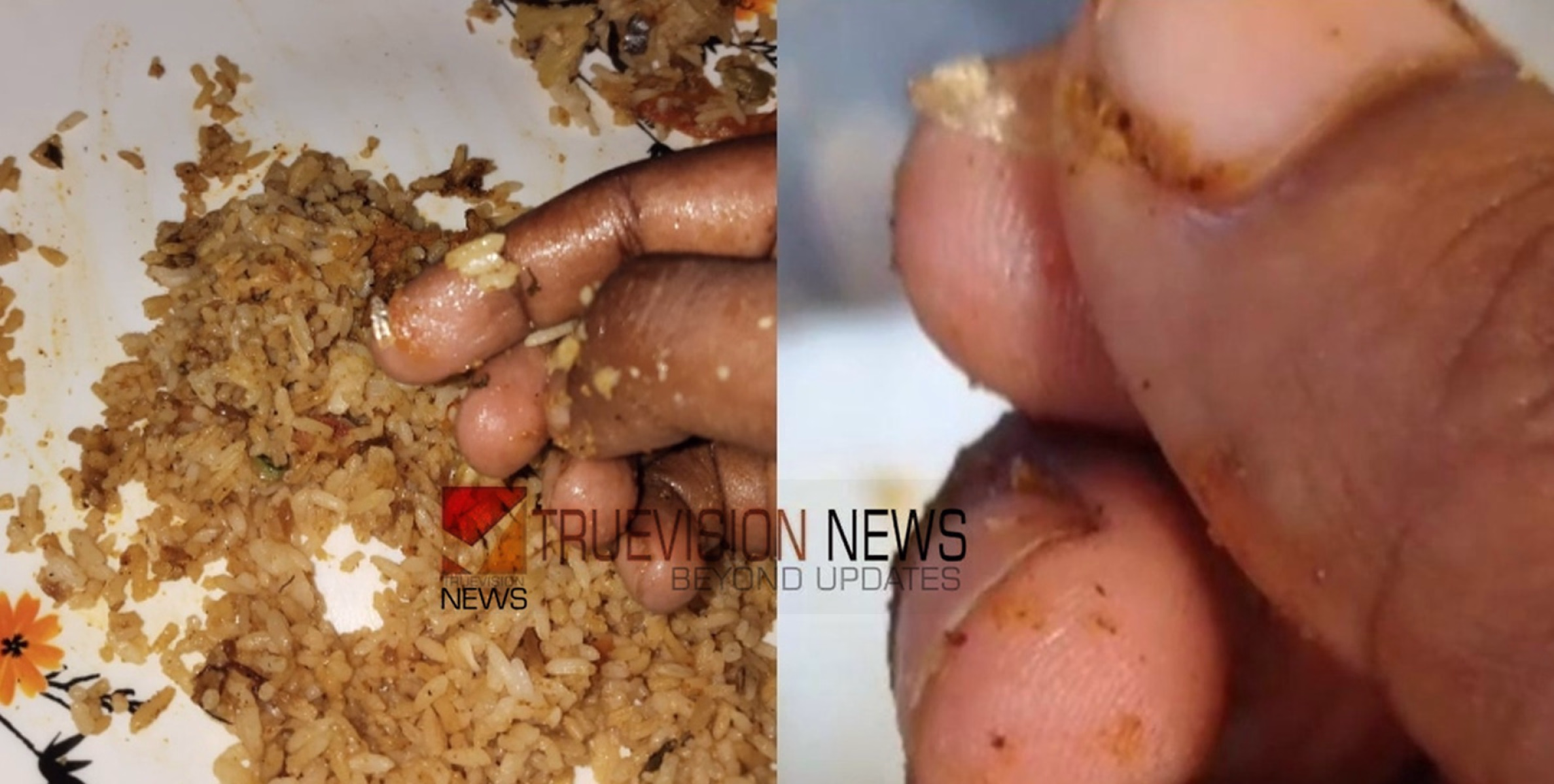 പുതിയ മസാല കൂട്ട് ആവുമല്ലേ...; ഹോട്ടലിൽ നിന്നും വാങ്ങിയ ബിരിയാണിയിൽ നിന്ന് കുപ്പിച്ചില്ല്, തൊണ്ടയിൽ കുടുങ്ങി മുറിഞ്ഞു