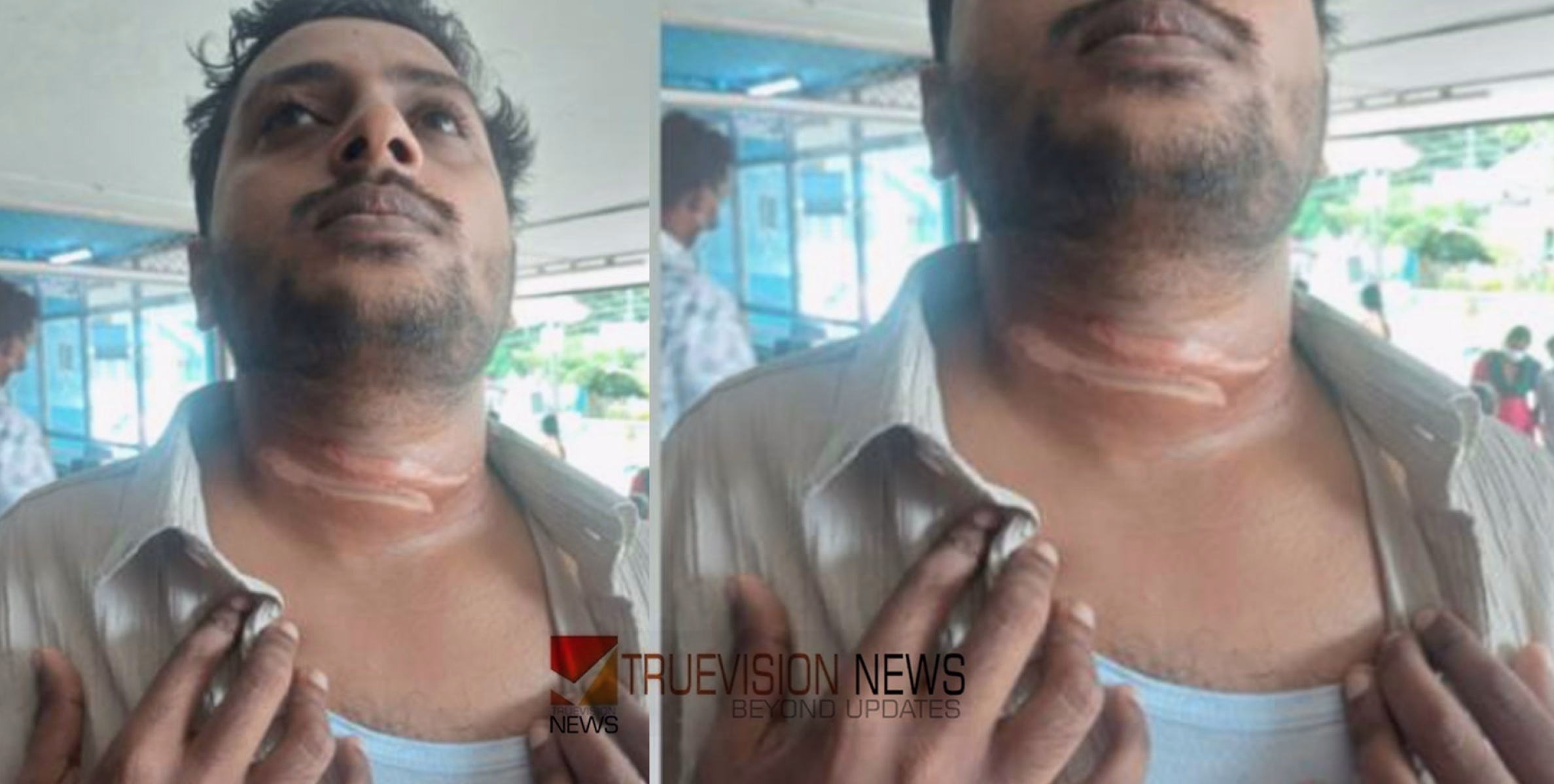 ജീവൻ പോലും അപകടത്തിൽ; ബൈക്കിൽ പോകുന്നതിനിടെ ഇന്‍റര്‍നെറ്റ് കേബിള്‍ പൊട്ടിവീണ് കഴുത്തിൽ കുടുങ്ങി, അധ്യാപകന് പരിക്ക്