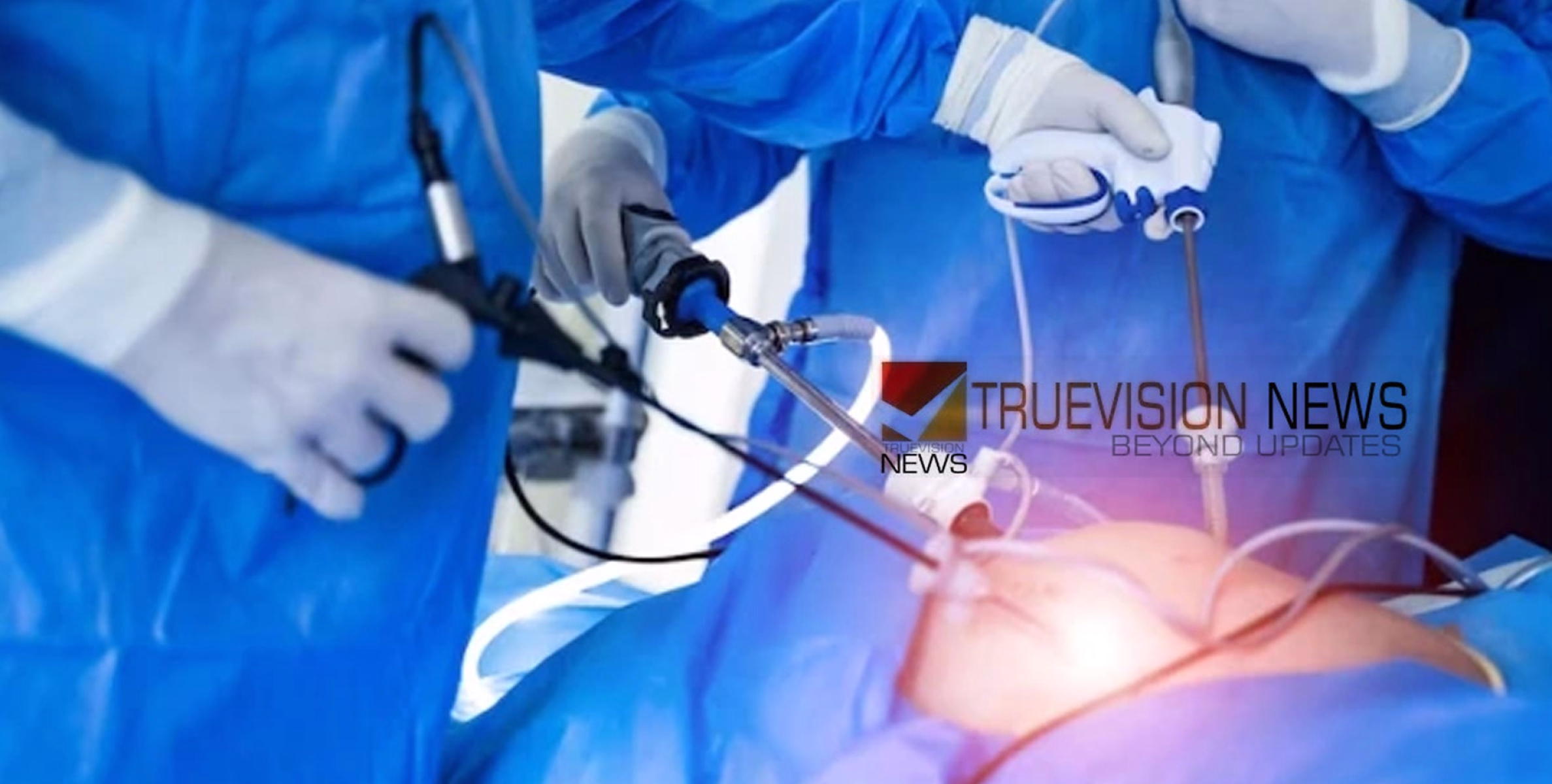 ആശങ്ക അകറ്റാം; ഹെർണിയക്ക് പരിഹാരമായി പാർകോയിൽ ലാപ്പറോസ്കോപിക് ശസ്ത്രക്രിയ 