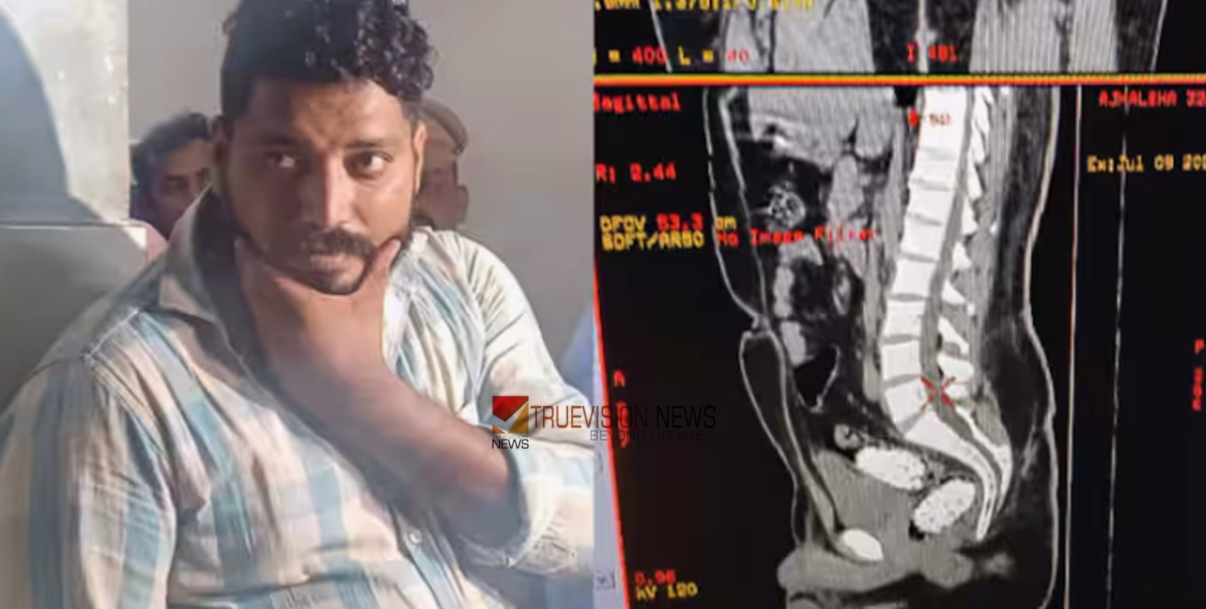 ഗർഭനിരോധന ഉറകളിൽ എംഡിഎംഎ നിറച്ച് മലദ്വാരത്തിൽ ഒളിപ്പിച്ചു; അജ്മൽ ഷാ പൊലീസിന്റെ നോട്ടപ്പുള്ളി, ഒടുവിൽ പിടിയിൽ  