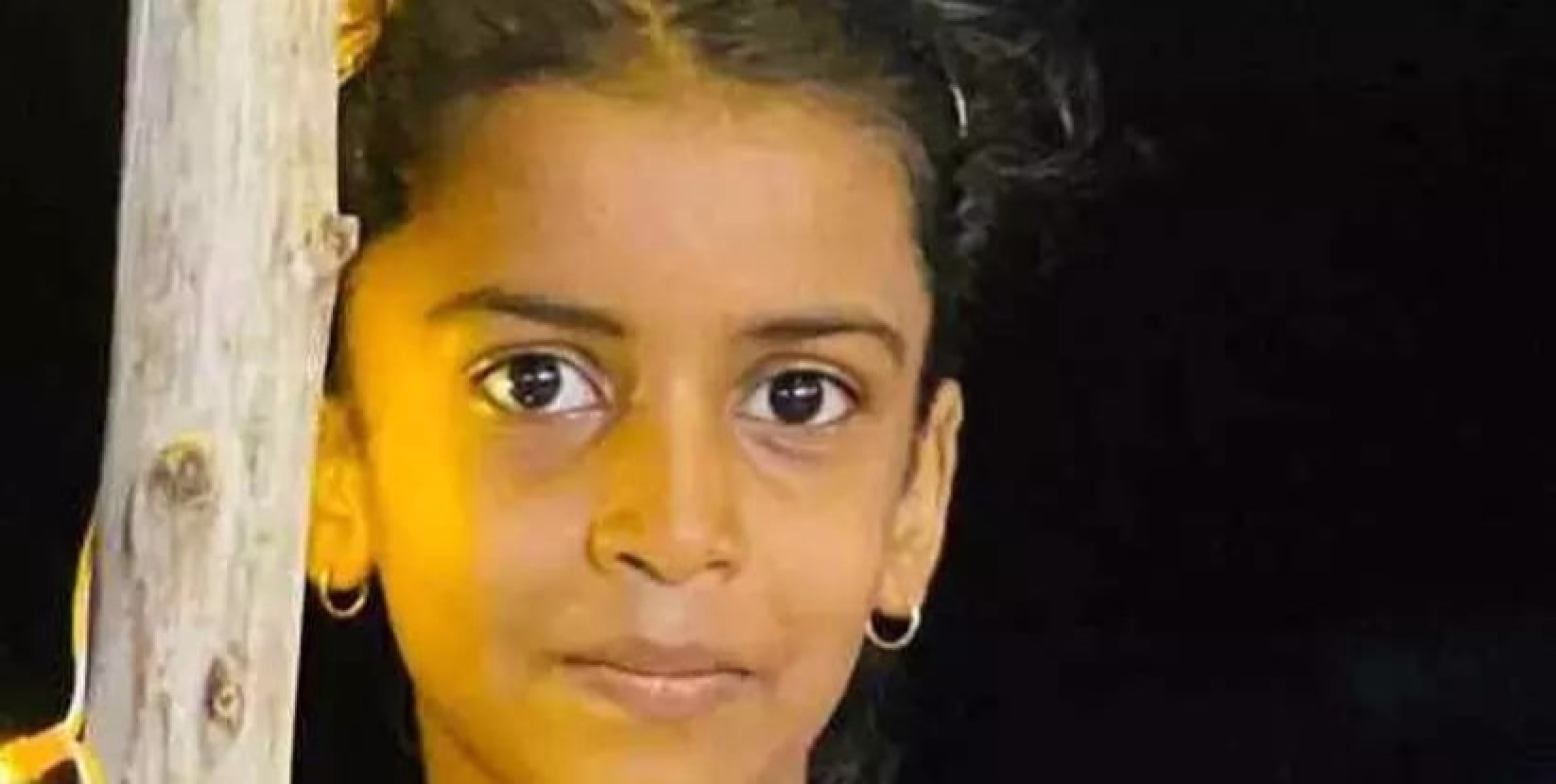 വളർത്തുപൂച്ചയുടെ നഖം കൊണ്ട് ചികിത്സയിലായിരുന്ന പെൺകുട്ടി മരിച്ചത് പേവിഷബാധ മൂലമല്ല