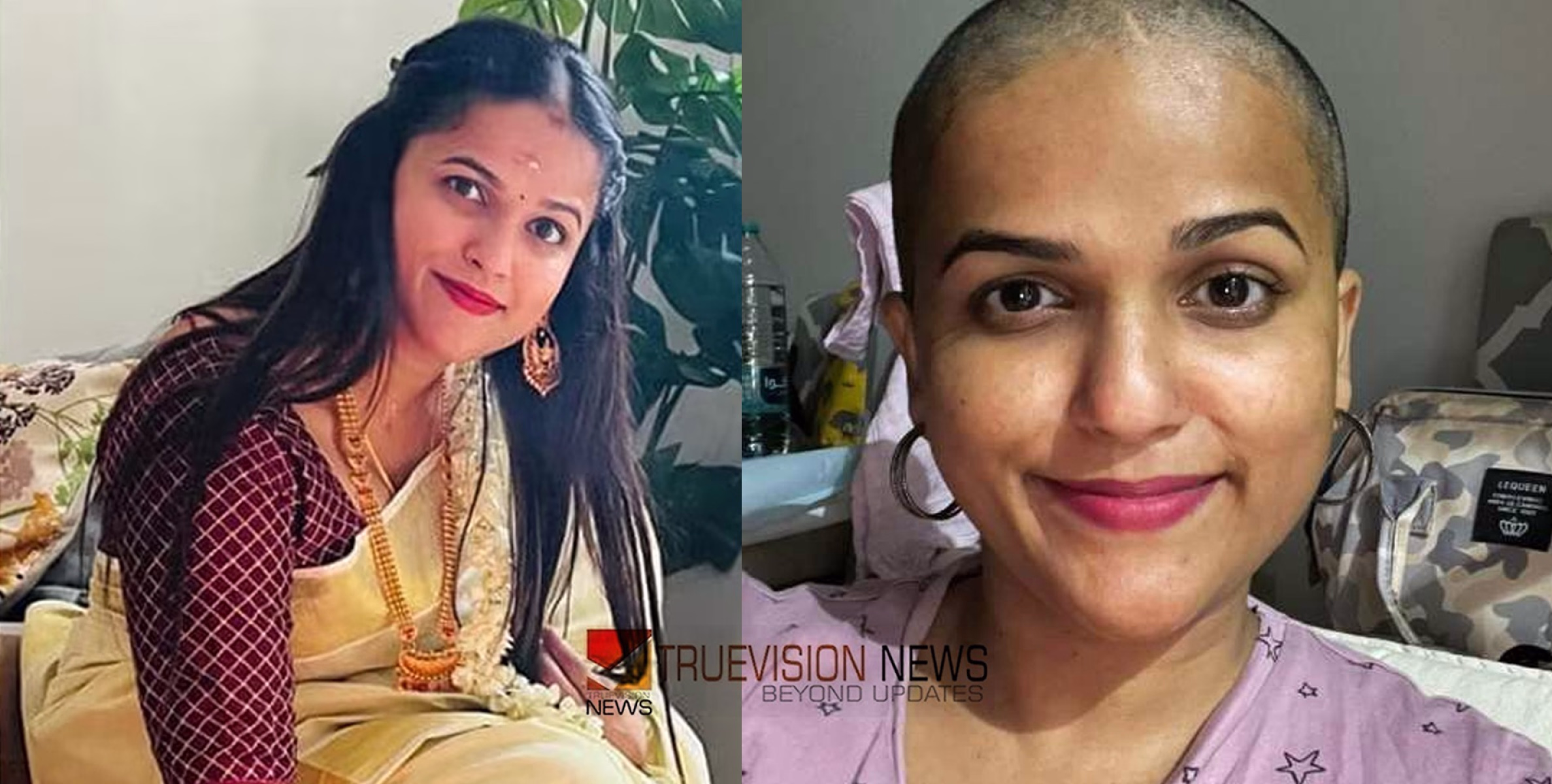 ശരീരത്തിൽ പാടുകൾ, വിപഞ്ചികയുടെ മൃതദേഹത്തിന്റെ റീ പോസ്റ്റുമോർട്ടം പുരോഗമിക്കുന്നു