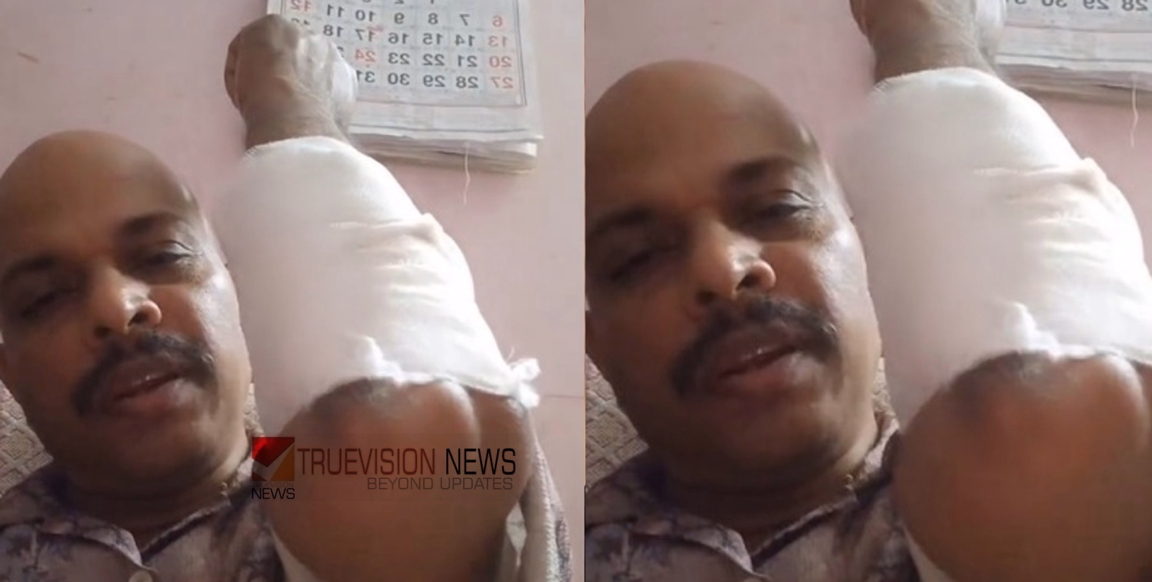 'ഒന്നുകിൽ കൊന്നൊടുക്കണം; അല്ലെങ്കിൽ കൂട്ടിലിട്ട് വളർത്തണം', തെരുവുനായ കുറുകെ ചാടി പൊലീസ് ഉദ്യോഗസ്ഥന് പരിക്ക്