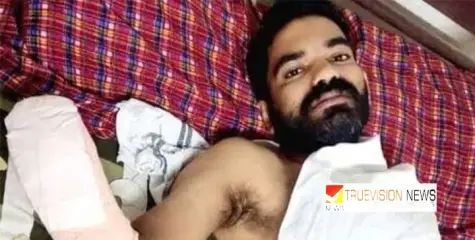 കുളം വൃത്തിയാക്കുന്നതിനിടെ മുഷു മത്സ്യത്തിന്റെ കുത്തേറ്റു ; തലശേരി സ്വദേശിയായ  യുവാവിന്റെ വലതു  കൈപ്പത്തി മുറിച്ച്‌ മാറ്റി.