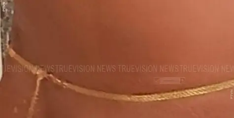 കടിയങ്ങാട് വെച്ച് സ്വര്‍ണ്ണാഭരണം നഷ്ടപ്പെട്ടു