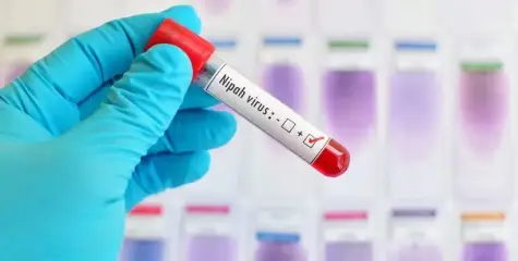 സംസ്ഥാനത്ത് വീണ്ടും നിപ ;  ചികിത്സയിലായിരുന്ന വളാഞ്ചേരി സ്വദേശിക്ക് രോഗം സ്ഥിരീകരിച്ചു 