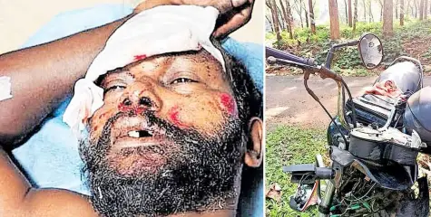 കാട്ടുപന്നിക്കൂട്ടം കുറുകെ ചാടി; ബൈക്ക് മറിഞ്ഞ് ദമ്പതികൾക്ക് പരുക്ക്