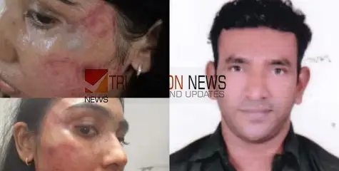 കൈ എന്താ ഇരുമ്പാണോ? ജൂനിയര്‍ അഭിഭാഷകയ്ക്ക് സീനിയര്‍ അഭിഭാഷകന്‍റെ ക്രൂര മർദ്ദനം