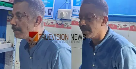 സ്വത്ത് തട്ടാൻ ശ്രമമെന്ന് പരാതി; വളയത്ത് പ്രവാസിയെ വീട്ടിൽ കയറി ക്രൂരമായി അക്രമിച്ചു