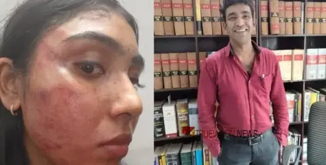 ജൂനിയർ അഭിഭാഷകയെ മർദ്ദിച്ച സംഭവം: പ്രതി ബെയ്‌ലിന്‍ ദാസ് ഒളിവില്‍; ചുമത്തിയത് ദുർബല വകുപ്പുകളെന്ന് ആരോപണം