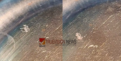 കുഞ്ഞ് അനുഭവിച്ചത് അസഹ്യമായ വേദന, മൂന്നര വയസ്സുകാരന്റെ കണ്ണിൽ ഭീമൻ വിര; സങ്കീർണ ശസ്ത്രക്രിയയിൽ ആശ്വാസം 