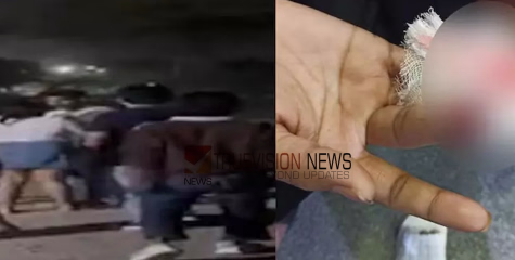 പിറന്നാൾ ആഘോഷം കഴിഞ്ഞ മടങ്ങുന്നതിനിടെ പെൺകുട്ടികൾക്ക് നേരെ ആൾക്കൂട്ടാക്രമണം; ഒരാളുടെ വിരലിൽ കടിച്ചു മുറിച്ചു 