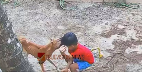 മമ്പറത്ത് വീട്ടുമുറ്റത്തു കളിക്കുകയായിരുന്ന നാലരവയസ്സുകാരനെയടക്കം നാലുപേരെ  തെരുവുനായകൾ ആക്രമിച്ചു ; കുട്ടിയുടെ ചുമലിന്  ഗുരുതര പരിക്ക്