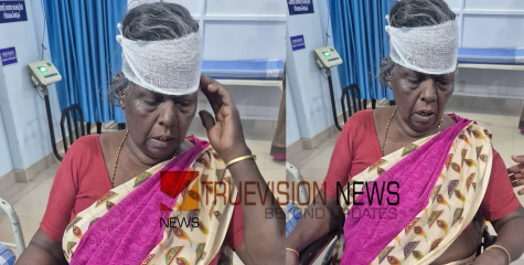  കുറുവന്തേരിയിൽ തൊഴിലുറപ്പ് തൊഴിലാളികൾക്ക് നേരെ കാട്ടുപന്നി അക്രമം; സ്ത്രീക്ക് പരിക്ക് 