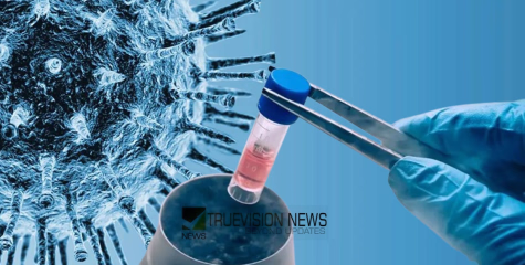 നിപ സമ്പർക്കപ്പട്ടികയിലുള്ള സ്ത്രീയുടെ മരണം; പരിശോധനാ ഫലം നെഗറ്റീവ്, പ്രതിരോധ പ്രവർത്തനങ്ങൾ ശക്തമാക്കാൻ നിർദേശം