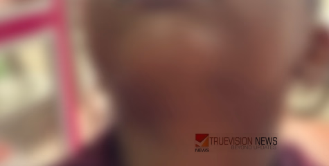 കുരുന്ന് നോവിന് വിലയില്ലേ ...? ചേർത്തലയിൽ അഞ്ചു വയസ്സുകാരനെ കുട്ടിയെ അമ്മയും അമ്മൂമ്മയും ചേർന്ന് ക്രൂരമായി മർദ്ദിച്ചതായി പരാതി 