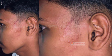 പ്ലസ്ടു വിദ്യാര്‍ത്ഥികളുടെ റാഗിങ്; 2 വിദ്യാര്‍ഥികള്‍ക്ക് പരുക്ക്