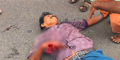 കോഴിക്കോട് ബാലുശ്ശേരിയിൽ  ബൈക്ക് കണ്ടെയിനര്‍ ലോറിയിലേക്ക് ഇടിച്ച് കയറി അപകടം; ബൈക്ക് യാത്രികന് ഗുരുതര പരിക്ക്