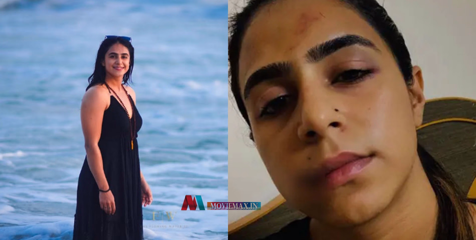 വയറ്റിൽ ചവിട്ടി മുഖത്തിടിച്ചു, മേൽചുണ്ട് കീറി കിടക്കയിലാകെ ചോര; മുൻപങ്കാളിയുടെ ആക്രമണം വെളിപ്പെടുത്തി നടി ജസീല പർവീൺ