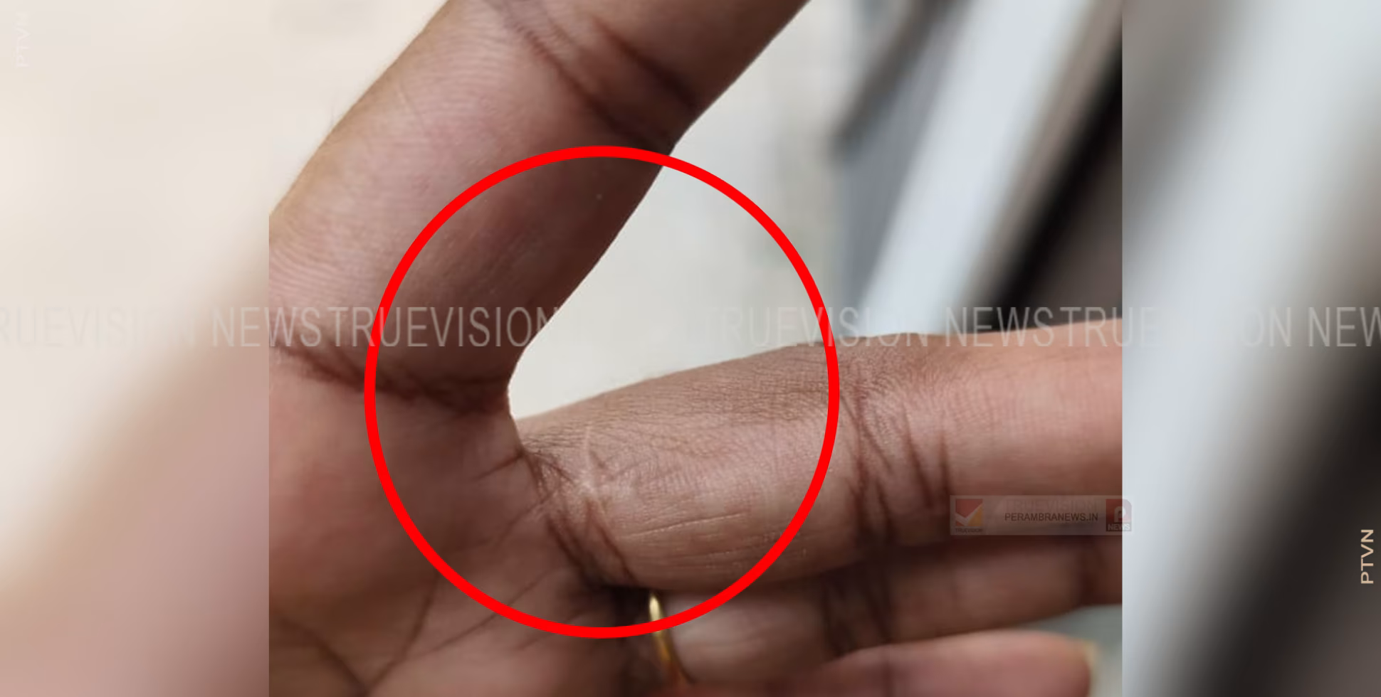 ഗാര്‍ഹിക പീഡനം ; ബാലുശ്ശേരിയില്‍ ഭര്‍തൃവീട്ടില്‍ യുവതിക്കു നേരെ പീഡനം